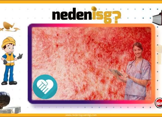 Cilt Kanseri Yapan Maddeler ve İşler