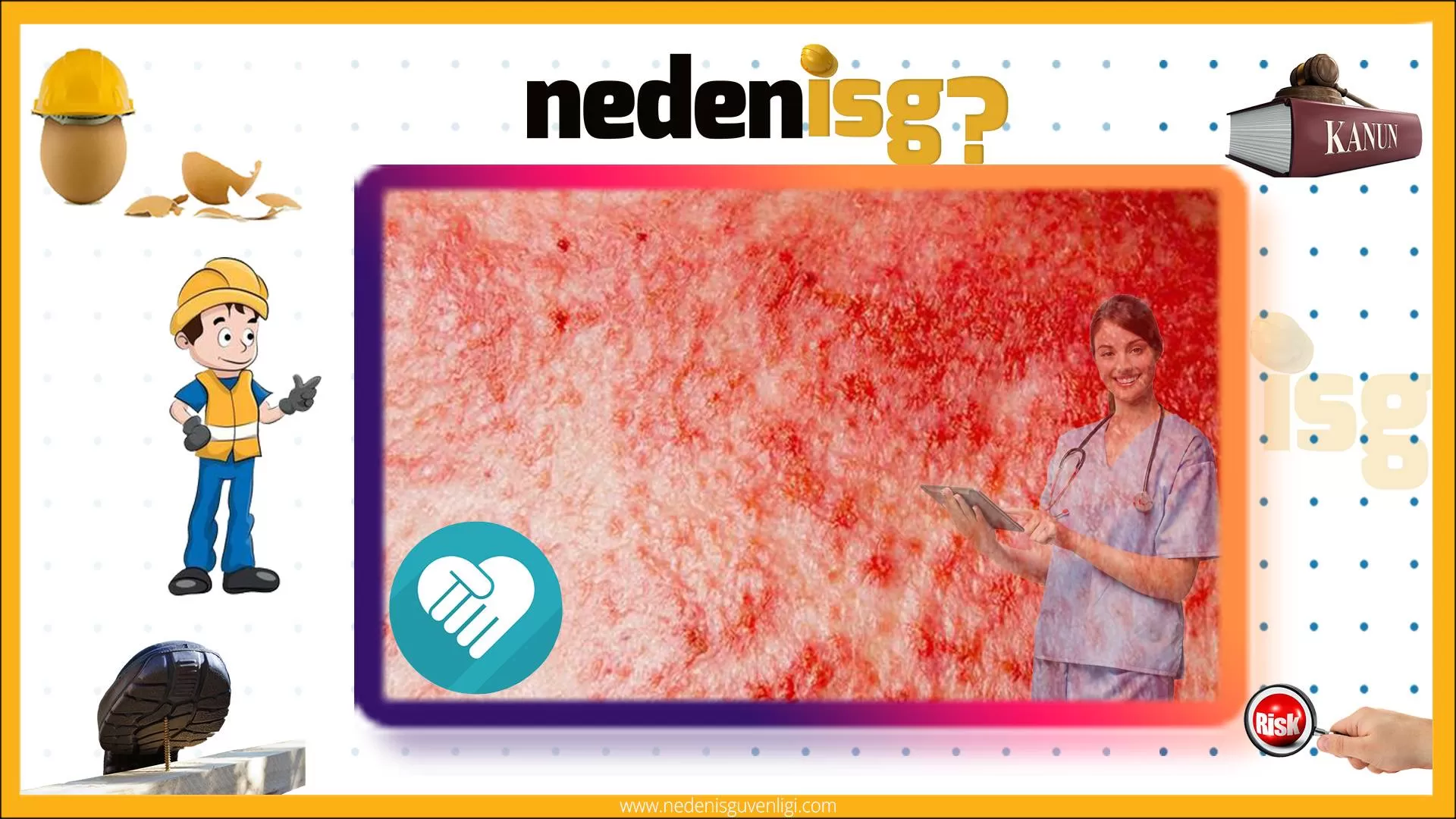 Cilt Kanseri Yapan Maddeler ve İşler