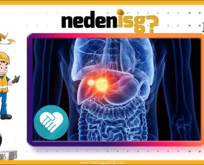 Siroz hastalığı neden olur, belirtileri nelerdir?