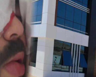 200 liralık koruyucu gözlük verilmeyen işçi kör kaldı!