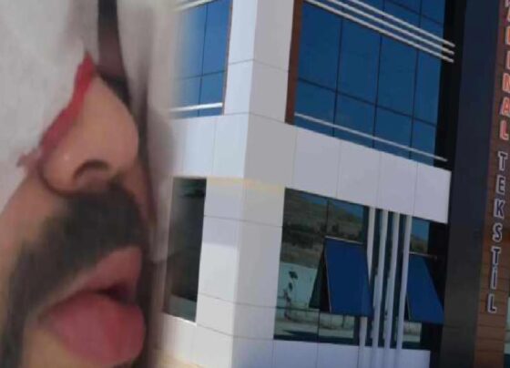 200 liralık koruyucu gözlük verilmeyen işçi kör kaldı!