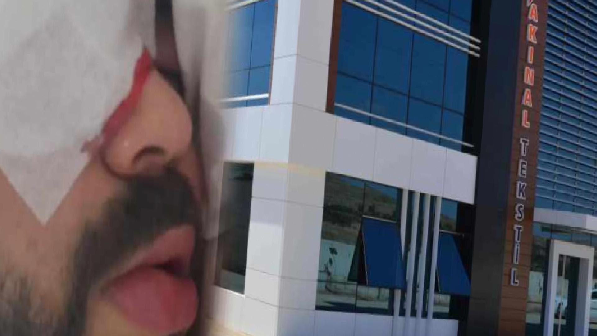 200 liralık koruyucu gözlük verilmeyen işçi kör kaldı!