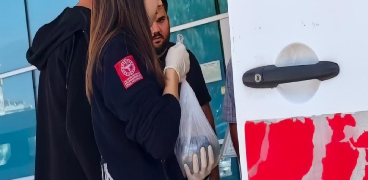 Bursa’da iş kazası: 24 yaşındaki işçinin parmağı makinede koptu 1 Bursa’da iş kazası: 24 yaşındaki işçinin parmağı makinede koptu